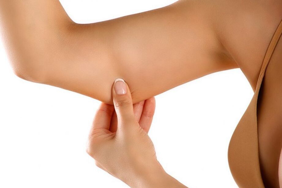 eliminar celulitis en brazos