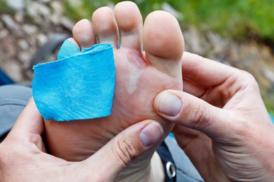 Cómo correr con ampollas en los pies la mejor forma de vendarlos